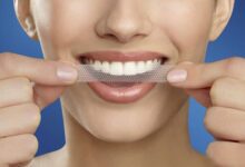 Photo of 3 Things You Must Avoid When Working On Teeth Whitening