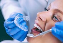 Photo of Questions You Need to Ask About Dental Implants