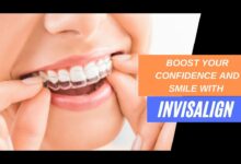 Photo of Boost Your Confidence And Smile With Invisalign