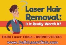 Photo of Laser hair removal How does it work? Brampton residents’ FAQ