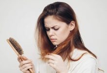 Photo of Seven common causes of Hairloss you never imagine