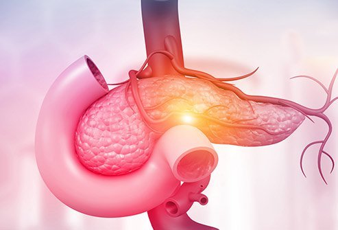 Pancreatic Cancer Causes, Prognosis And Treatment