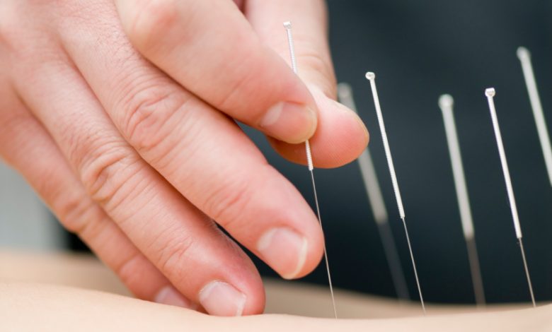 Victoria Acupuncture