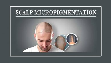 Photo of How is Scalp Micropigmentation treatment Beneficial for hair loss?