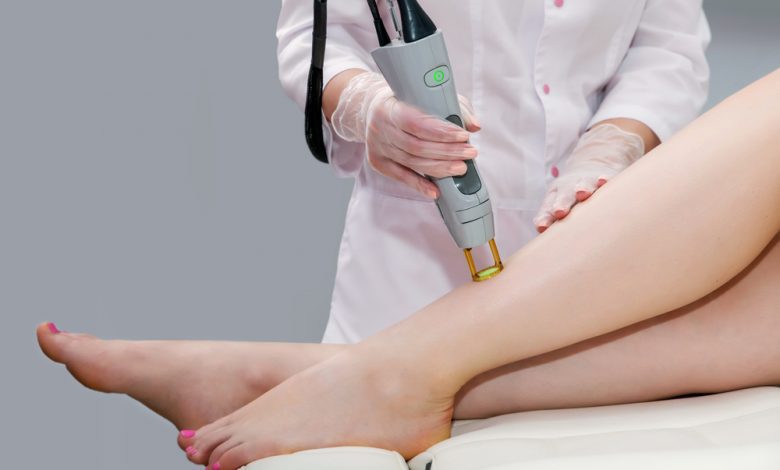 Laser Hair Removal