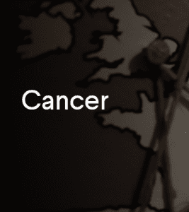 cancer