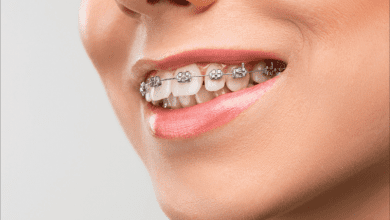 Photo of 7 Reasons Invisalign Is the Most Effective Orthodontic Treatment