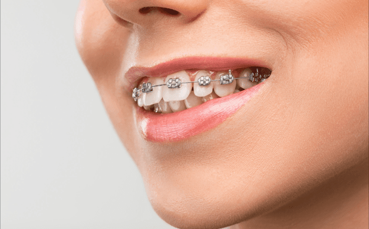 dental implants Hammersmith