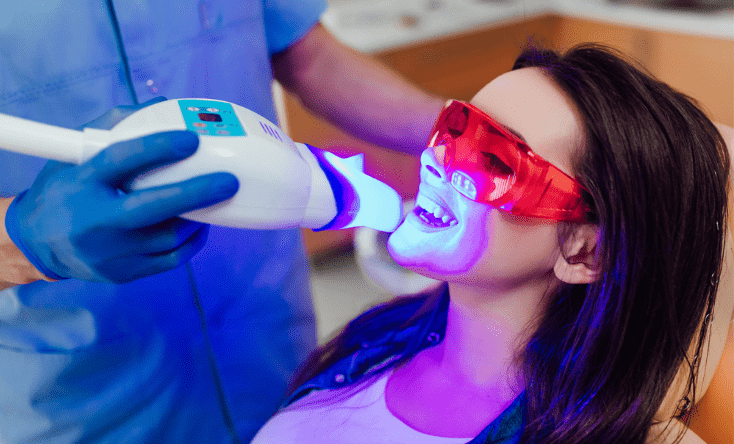 Laser Teeth Whitening