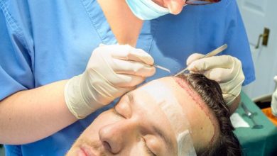 Photo of Interaction of Hair Transplant: You want to know