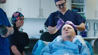 Photo of Hair transplant movement: You need to know
