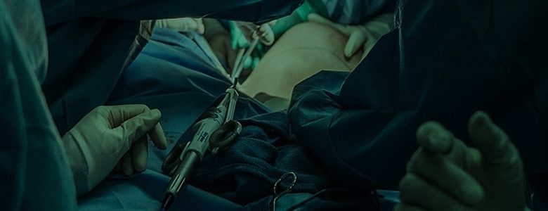 Laparoscopic GI Surgery Treatments