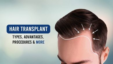 Photo of Things To Follow For A Better Hair Transplant Result Post-Treatment
