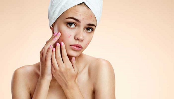 skin care tips - oily skin