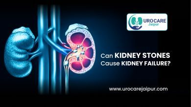 Photo of Can kidney stones cause kidney failure? – Dr. Lokesh Sharma