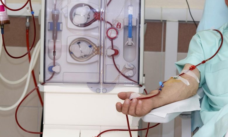 dialysis treatment