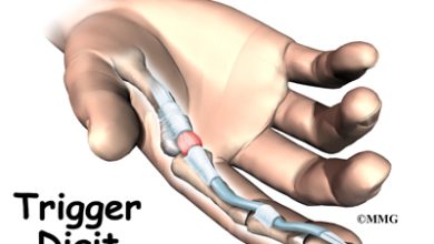 Photo of How to find the best treatment for trigger fingers in Singapore?`