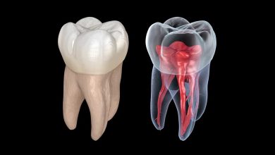 Photo of Who Is a Root Canal Specialist? Why Do You Need One?