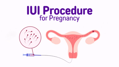 Photo of Intrauterine Insemination (IUI) – What Does it Mean and What You Should Expect?