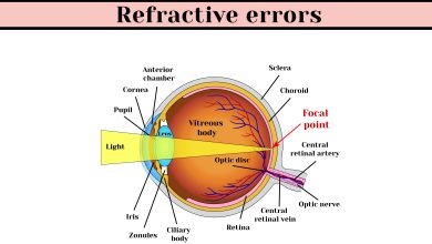 Photo of All you need to know about Refractive error