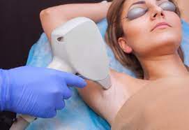 Photo of Is Laser Hair Removal Permanent?
