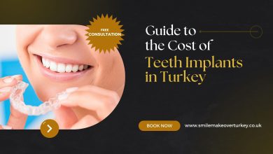 Photo of Guide to the Cost of Teeth Implants in Turkey