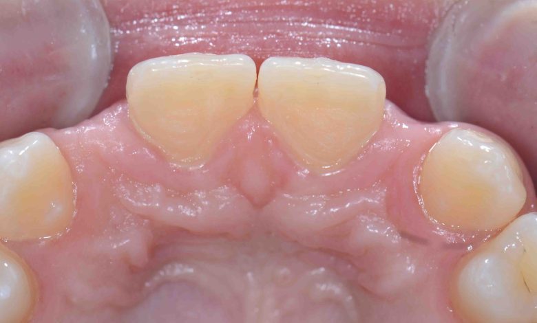 marlyand bridges dental