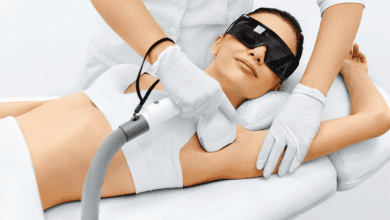 Photo of What are the Benefits of Laser Hair Removal Treatment?