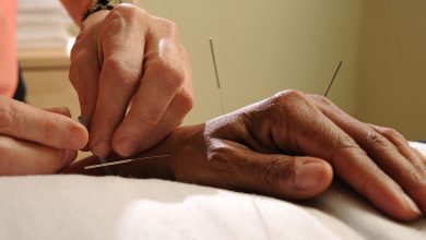 Photo of What are acupuncture’s positive effects on health?