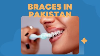 Photo of Braces in Pakistan