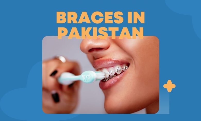 Braces in Pakistan