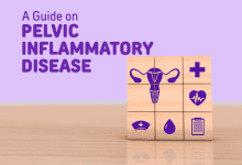 Photo of Pelvic Inflammatory Disease (PID) – A Guide