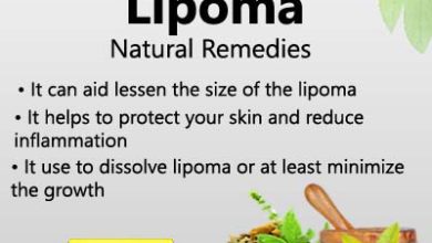 Photo of 10 Ways to Remove a Lipoma Without Surgery