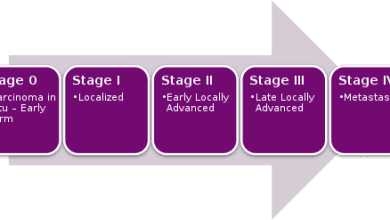 Photo of What does stage 5 cancer mean?