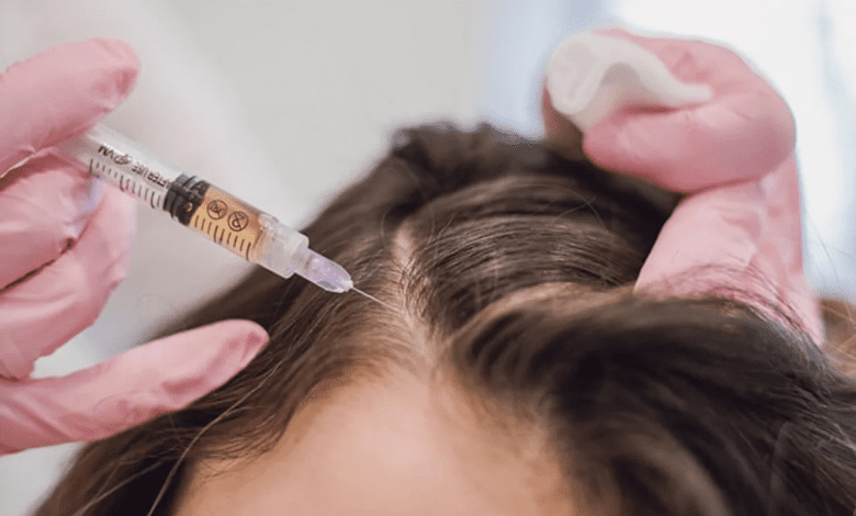 GFC therapy for hair fall