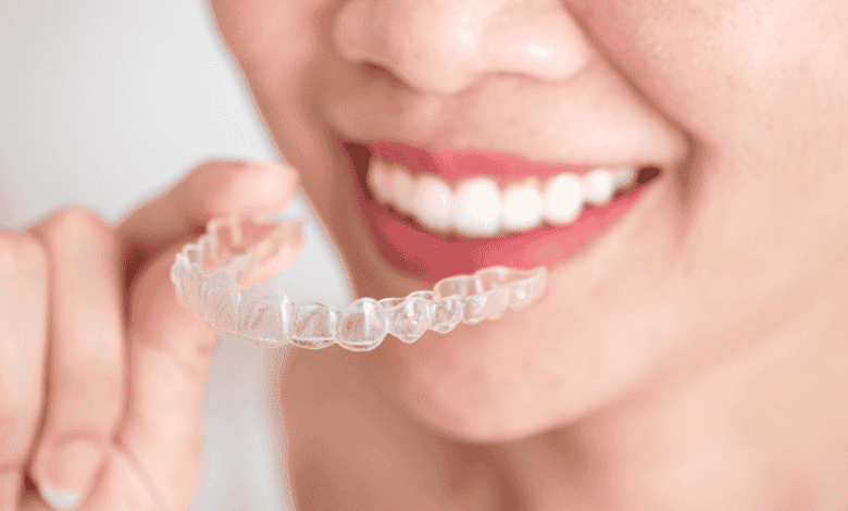 Invisalign dentist in Burlington